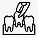 Chirurgia stomatologiczna - usuwanie ósemek Tarnów - ekstrakcje zębów